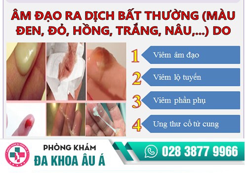 NGUYÊN NHÂN KHIẾN HUYẾT TRẮNG CÓ MÙI LẠ
